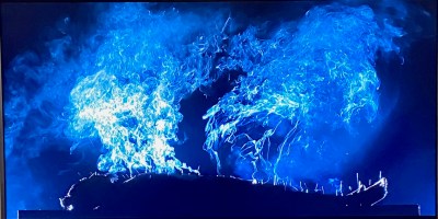 Screenshot from a film, body lying on a table, covered in acupuncture needles and moxibustion nodes.